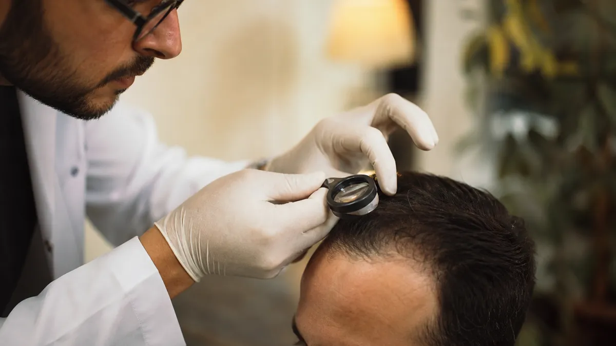 Greffe de cheveux : vérités sur les techniques et résultats