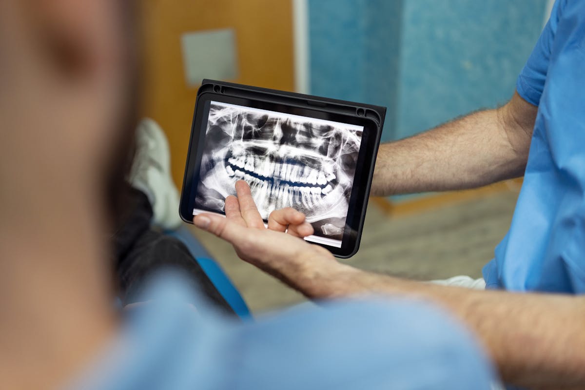 « Bone smashing » : pourquoi cette tendance inquiète les médecins ?