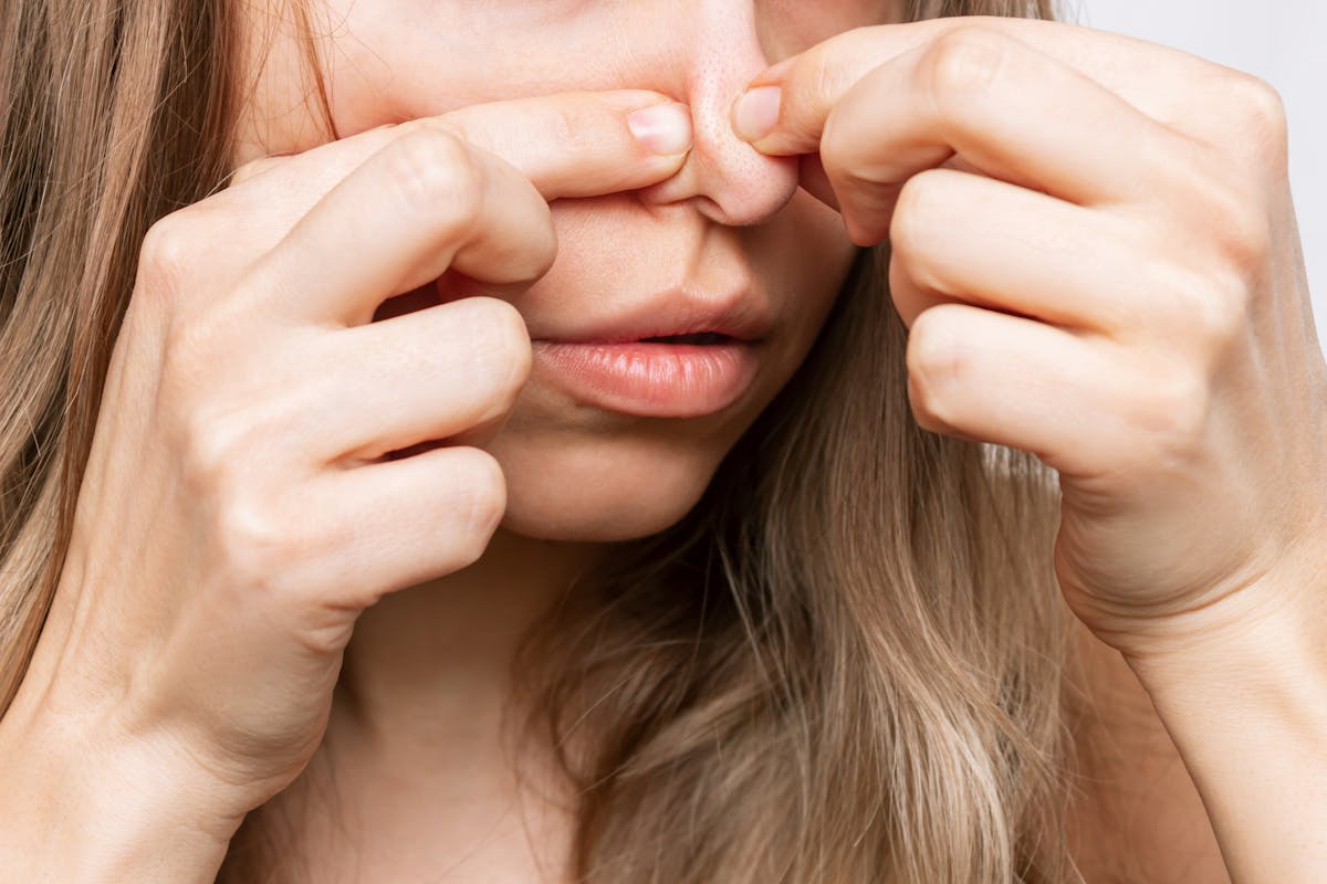 Comment faire partir les points noirs naturellement ?